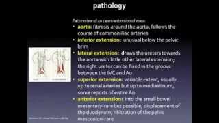 Retroperitoneal Fibrosis [upl. by Marlee]