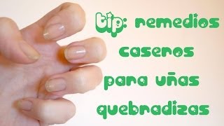 TIP remedios caseros para las uñas quebradizas [upl. by Daphne256]