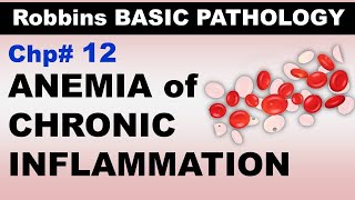 Ch12  Anemia of Chronic Inflammation  Blood Pathology  Dr Asif Lectures [upl. by Dugan]