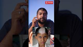 ജന്മനാ കേൾവിക്കുറവുള്ള കുട്ടികൾ  Waardenburg Syndrome hearingloss genetics shorts child ear [upl. by Alioz347]