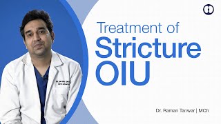 Urethral Stricture and Treatment by OIU Operation ke baad ke parhez [upl. by Minsat]