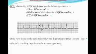 Principles of ECG quotelectrocardiographyquot Part 9 [upl. by Suedaht]