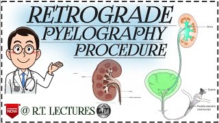 Retrograde Pyelography Procedure Retrograde Pyelogram  IndicationsContraindicationsProcedure [upl. by Adnoyek]