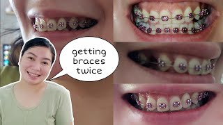 BRACES AGAIN FOR THE SECOND TIME🤔  HOW MUCH BRACES COST IN THE PHILIPPINES 2024 [upl. by Missy592]