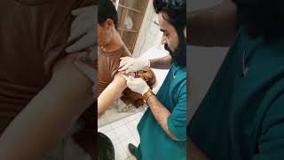 cyst drainage please subscribe for Moreتخلیه سیست تحت الجلدی [upl. by Crosley]