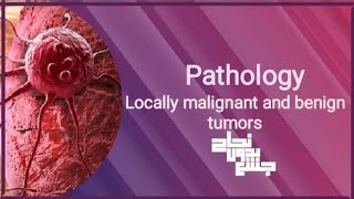 locally malignant and benign tumors pathoL17 part 1 [upl. by Read228]