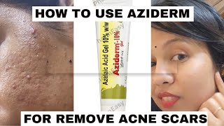 aziderm gel review honest reviewhow to use azelaic acid for acne amp acne marksacnetreatment viral [upl. by Tansey]