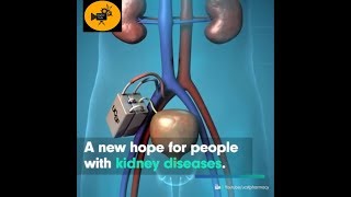 Research scientists are hard at work to create a bionic kidney [upl. by Yznil280]