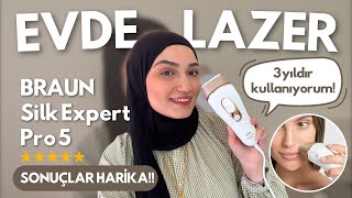 Braun Silk Expert Pro 5 İnceleme  3 Senelik Kullanım Sonuçlarım  Sonuçlar Harika evdelazer [upl. by Enidlarej]