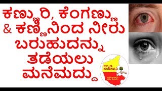 Home Remedies for Burning and Watering Eyes in Kannada  Eye pain treatment  Kannada Sanjeevani [upl. by Ahsemac]