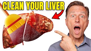 Top BEST Foods to Clean Out Your Liver [upl. by Kirit666]