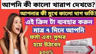 Melalite XL cream ফর্সা হওয়ার ক্রিম full review in bangla uses price dosage [upl. by Iren]