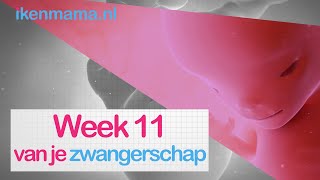 11 weken zwanger  ikenmamanl [upl. by Etnoek318]