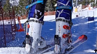 Ski Racer ACL Testimonial  Dr Richard Cunningham  Vail Colorado [upl. by Ridinger]