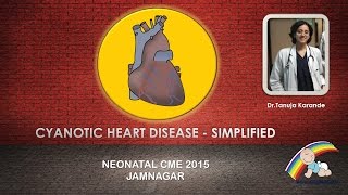 Cyanotic Heart Disease  Simplified By Dr Tanuja Karande [upl. by Spoor]