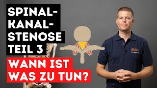 Spinalkanalstenose  Therapiereihenfolge  Was besonders wichtig ist  Teil 3 [upl. by Weiner391]