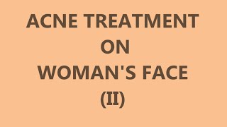 Acne Treatment on Womans Face II  Left side [upl. by Free]