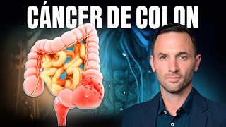 PÓLIPOS INTESTINALES el mejor amigo del CÁNCER DE COLON ¡Vence y previene A TIEMPO [upl. by Aelber908]