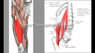 Correct Lordosis Part 23 [upl. by Suissac]