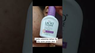 Lacto calamine face lotion review lacto calamine lotion for acne prone skin review shorts [upl. by Ellener]