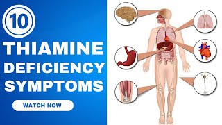 10 Thiamine Deficiency Symptoms  Thiamine Deficiency Neurological Symptoms [upl. by Rheta864]