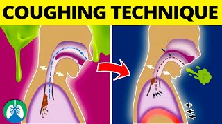 This COUGHING Technique Can Help Get Rid of Mucus and Phlegm ❗ [upl. by Patton579]