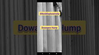 Dowagers Hump or Kyphosis Dowagershump kyphosis Spine Nclex Nursing worldexplorerindia Norcet [upl. by Furr422]